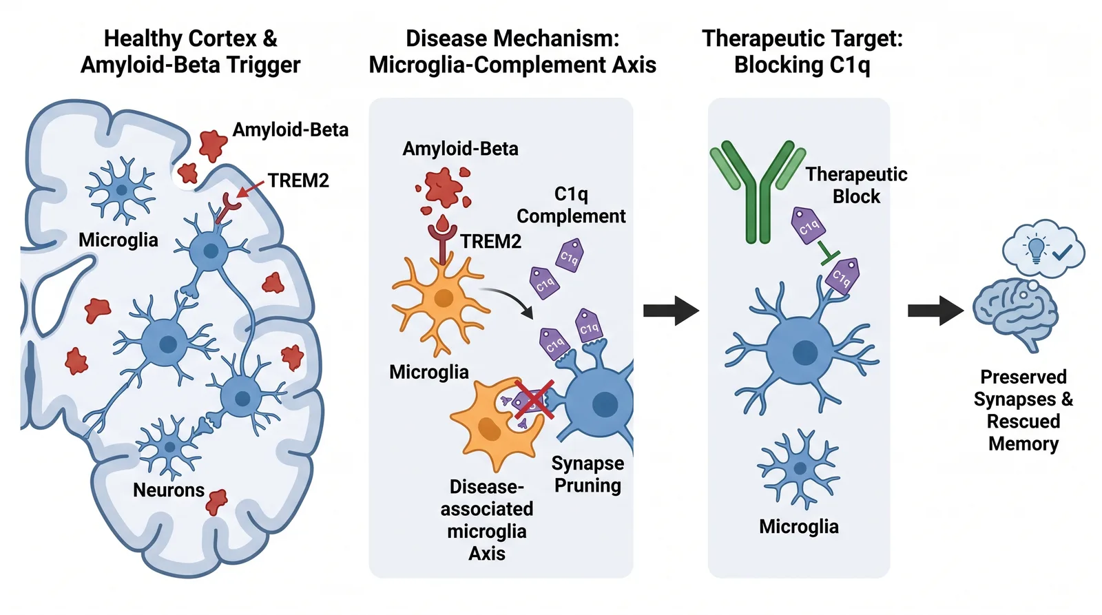 Alzheimer's disease neuroscience graphical abstract made with Graphab